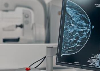 Nastavak realizacija projekta “Prevencija malignih i hroničnih nezaraznih bolesti kod žena u seoskim sredinama kroz reči i delo”
