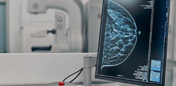 Nastavak realizacija projekta “Prevencija malignih i hroničnih nezaraznih bolesti kod žena u seoskim sredinama kroz reči i delo”