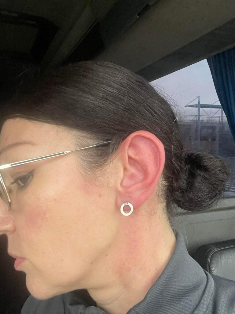 Jeleni Rankov polomili prst, ima nagnječenje levog uha i trpi veliki emotivni šok